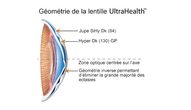 uh vaulted lens design FR